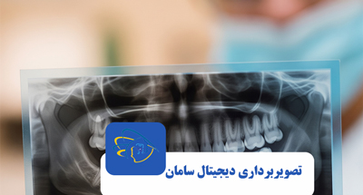 رادیوگرافی بایت وینگ